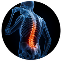 דלקת פרקים בעמוד השדרה